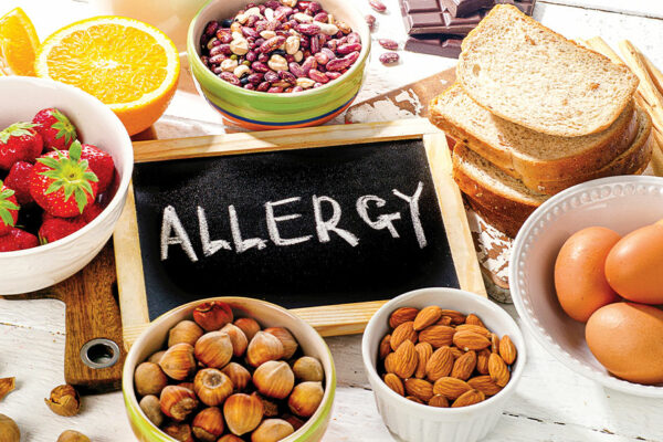 What Is a Food Allergy? 