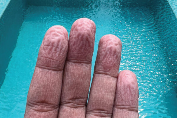 Study on Finger Wrinkles