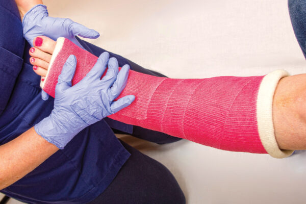 Fixing Fractures With Adhesives  