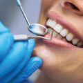 Repairing Teeth Using Wool - News for Kids