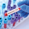 Hantavirus Triggers Panic