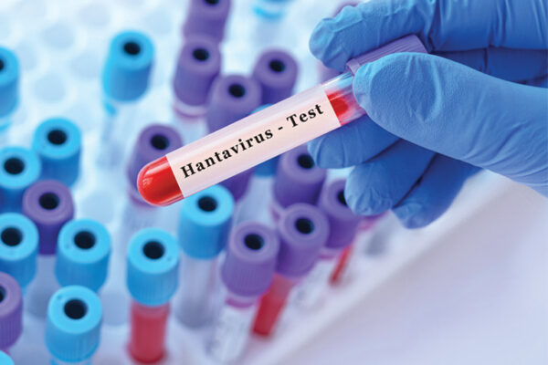 Hantavirus Triggers Panic