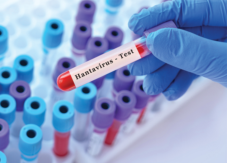Hantavirus Triggers Panic